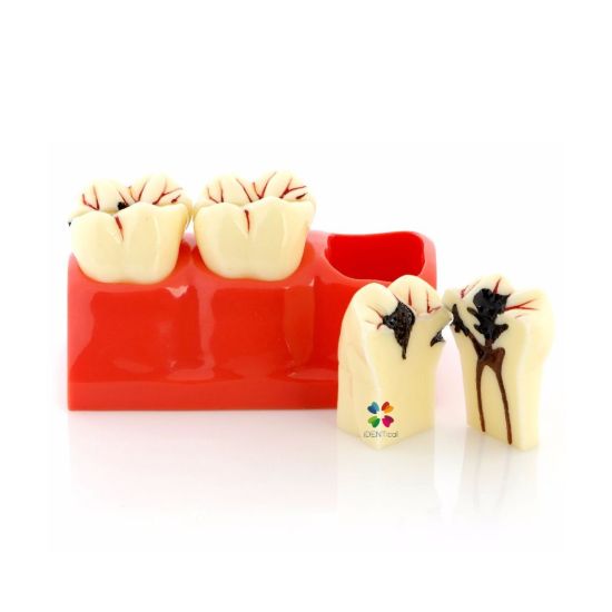 Picture of Caries Probe AIZ Original