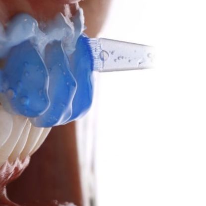 Picture of Clariant Angelus Tooth Whitenning