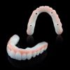 Picture of Composite Resin Veneer Mould Kit Ueneer