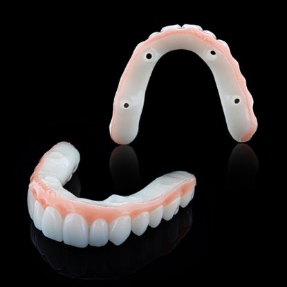 Picture of Composite Resin Veneer Mould Kit Ueneer