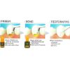 Picture of DiaPlus One-Step Bonding Agent Diadent Korea