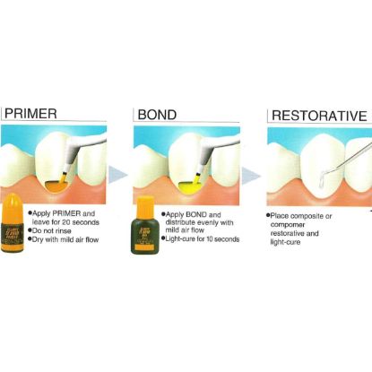 Picture of DiaPlus One-Step Bonding Agent Diadent Korea
