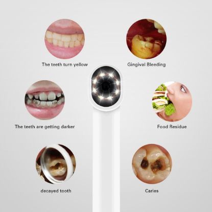 Picture of Intra Oral WiFi Dental Camera