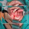 Picture of Langenbeck Right Angle Retractor