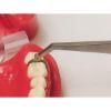 Picture of Matrix Holder Tweezer Type