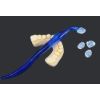 Picture of Occlusal Stamping Posterior Teeth Aesthetic Printing Kit