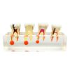 Picture of Root Canal Re-Treatment Files Dentsply Sirona Type Pattern
