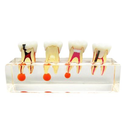 Picture of Root Canal Re-Treatment Files Dentsply Sirona Type Pattern
