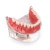 Picture of Tooth Jewellery