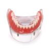 Picture of Tooth Jewellery
